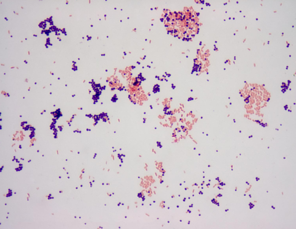 Microbiologia: Clasificación Gram Y Morfologia Microbiana